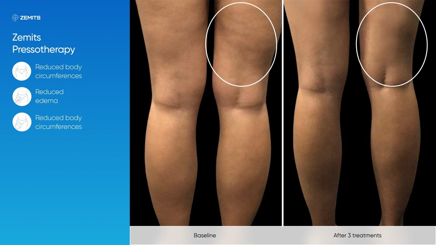 Zemits_real_results_1101.jpg My default image