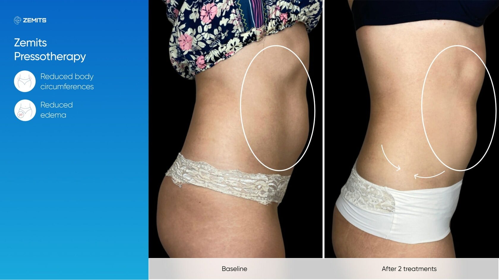 Zemits_real_results_1102.jpg My default image