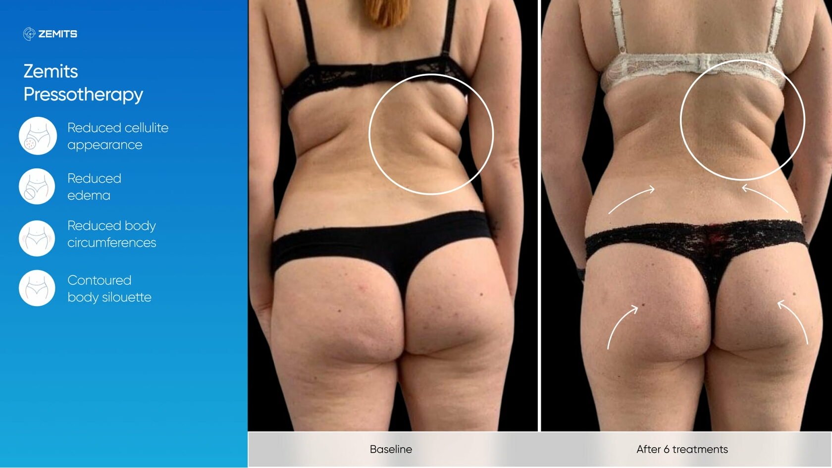 Zemits_real_results_1103.jpg My default image