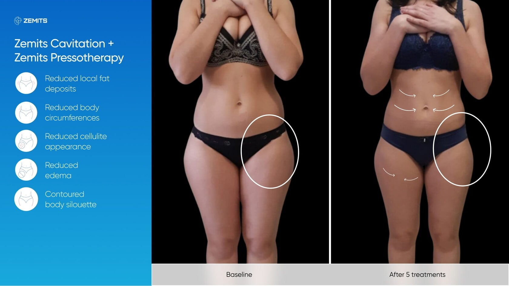 Zemits_real_results_1201.jpg My default image