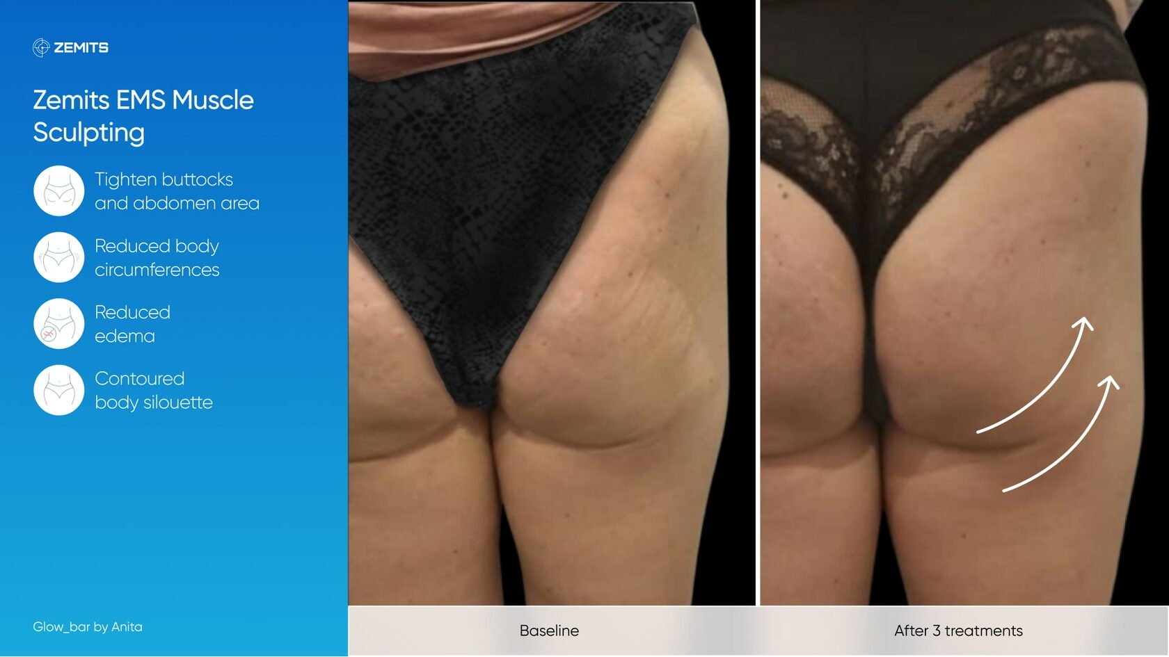 Zemits_real_results_1301.jpg My default image