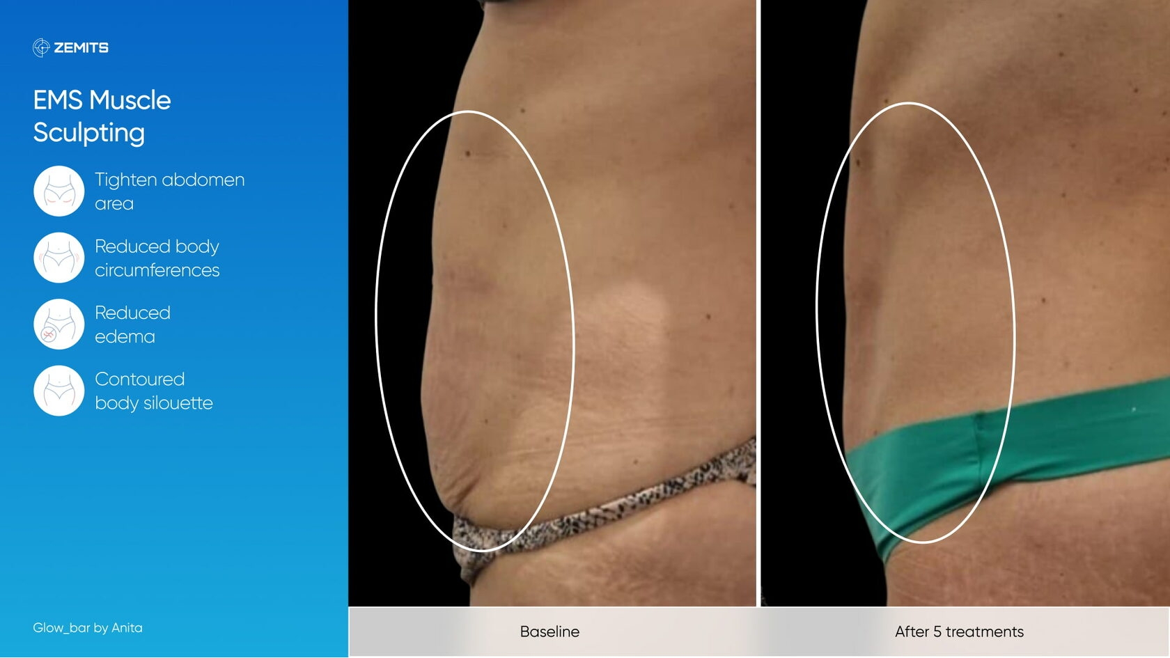 Zemits_real_results_1302.jpg My default image