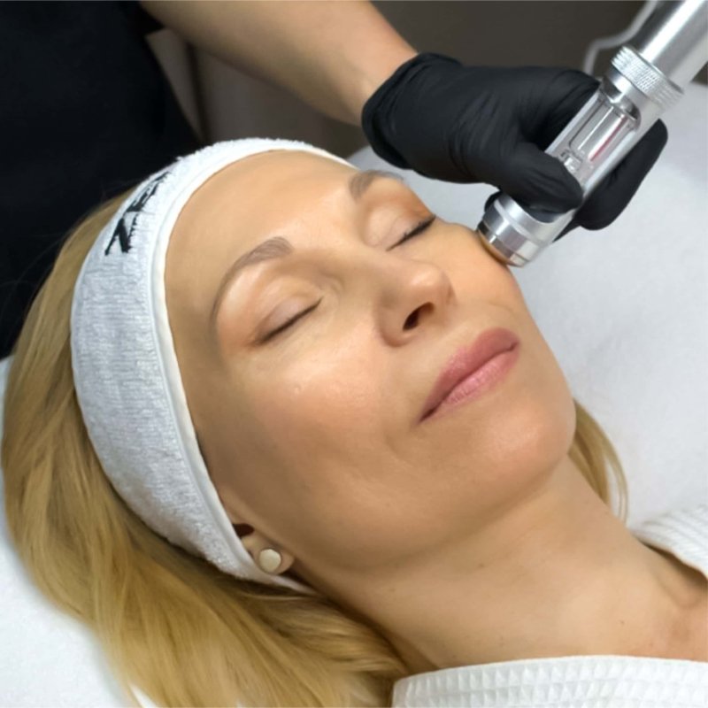 revtiaoxpro-02.jpg My default image