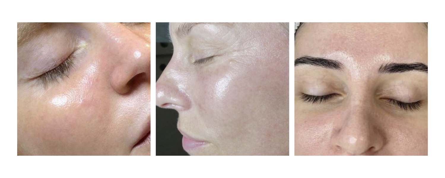 1.jpg My default image