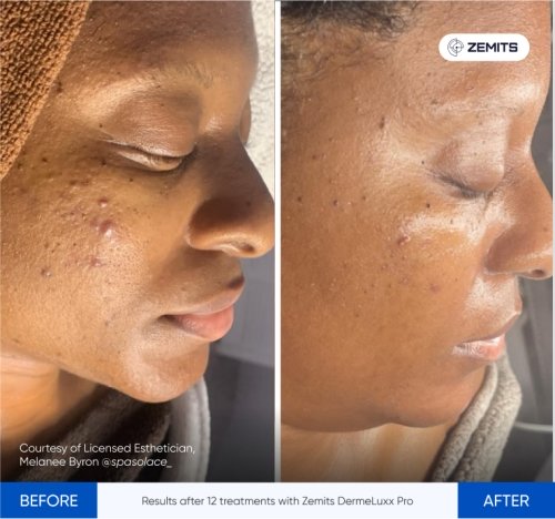 20 Skin Concern_ Pigmentation.jpg My default image