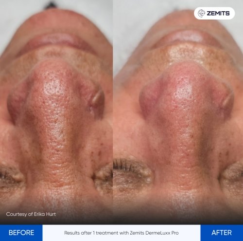 241434172.jpg My default image