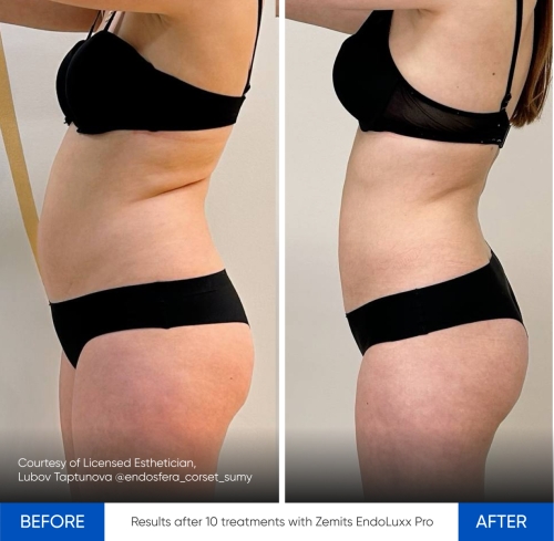 Zemits EndoLuxx Pro 4.jpg My default image